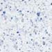 44-blue metallic fleck